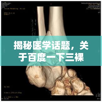 揭秘医学话题，关于百度一下三裸骨折吧的深入解析与探讨