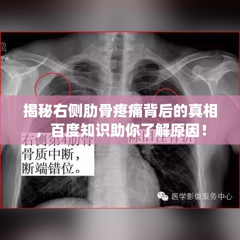 揭秘右侧肋骨疼痛背后的真相，百度知识助你了解原因！