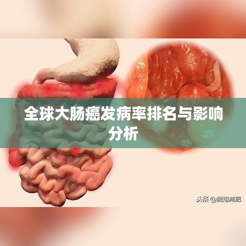 全球大肠癌发病率排名与影响分析
