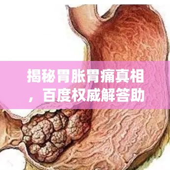 揭秘胃胀胃痛真相，百度权威解答助你轻松解决！