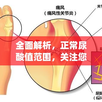 全面解析，正常尿酸值范围，关注您的健康生活！