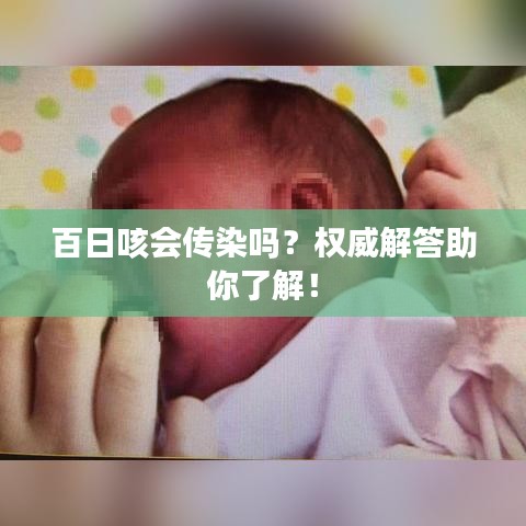 百日咳会传染吗？权威解答助你了解！